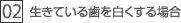 2.生きている歯を白くする場合